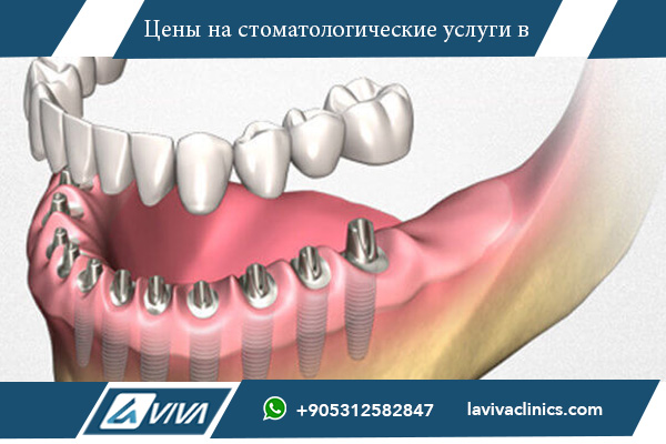 сколько стоит сделать все зубы в турции сколько стоит сделать все зубы в турции, цены на восстановление всех зубов в турции, стоимость полного лечения зубов в турции, доступное восстановление зубов в турции, лучшие клиники для восстановления всех зубов в турции, качественное лечение зубов в турции, отзывы о стоимости полного лечения зубов в турции, современные технологии полного восстановления зубов в турции