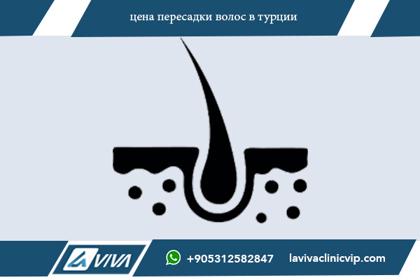 цена пересадки волос в турции цена пересадки волос в турции, стоимость пересадки волос в Турции, сколько стоит пересадка волос в Турции, доступная цена пересадки волос в Турции, лучшие клиники пересадки волос в Турции цены, отзывы о ценах пересадки волос в Турции, современные технологии пересадки волос в Турции, качественная пересадка волос в Турции