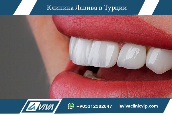 🦷 Стоматология за границей для россиян: 7 причин выбрать Турцию 🇹🇷