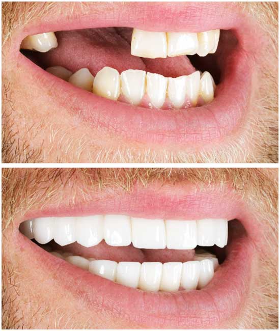 Фотографии до и после