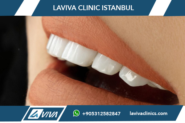 Эстэтычная стаматалогія ў Турцыі