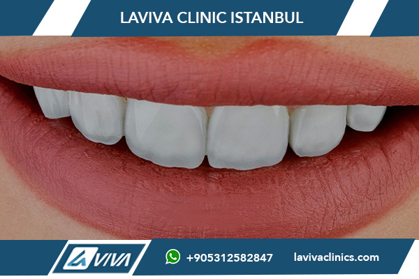 Усмешка Галівуд у Турцыі