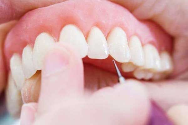 В якій країні найдешевше зробити зуби