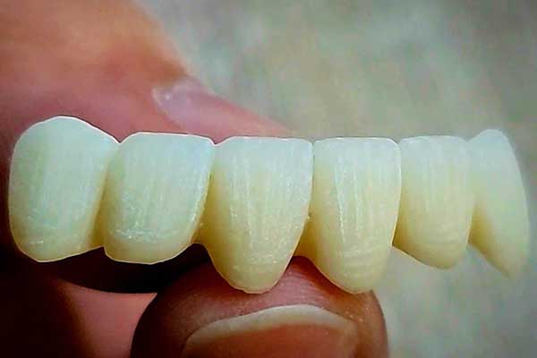 Лікування зубів у Туреччині