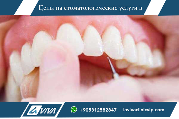 Отбеливание зубов в Стамбуле 2025: Полное руководство по современным методам и лучшим клиникам