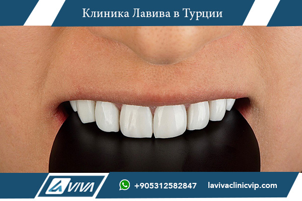 Турция или Казахстан для лечения зубов