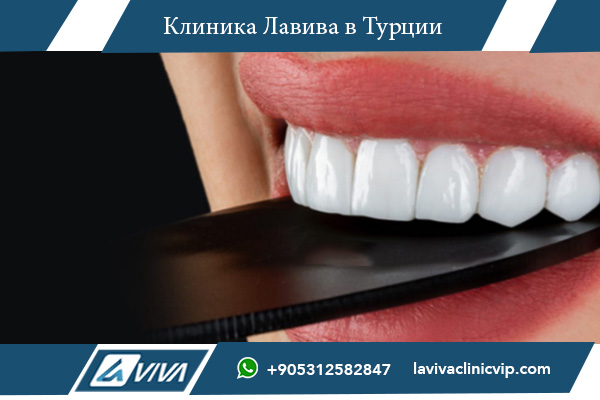 Мой неудачный опыт лечения зубов в Европе и удачный в Турции