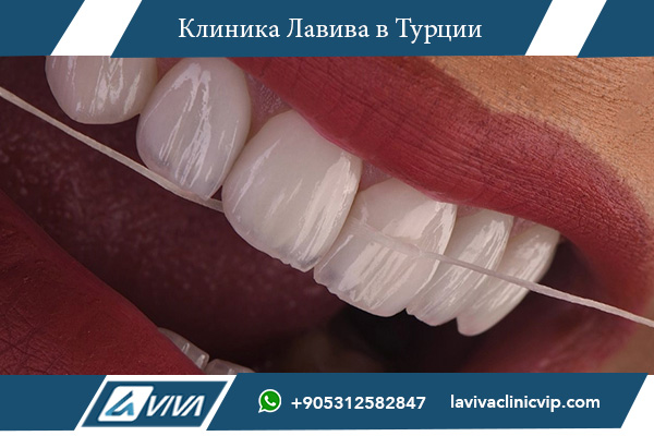 Сколько стоит голливудская улыбка в Турции
