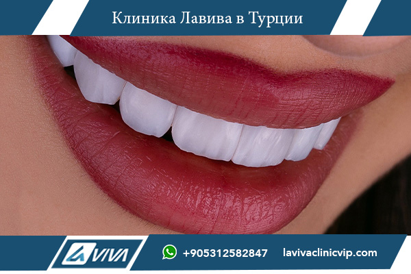 Какие документы нужны для лечения зубов в Турции