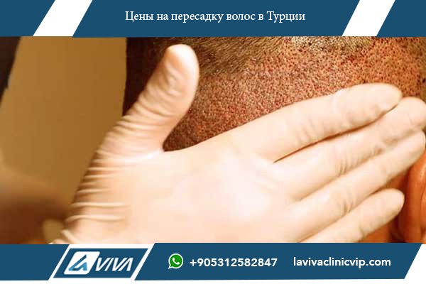 Лучшие клиники по пересадке волос в Стамбуле
