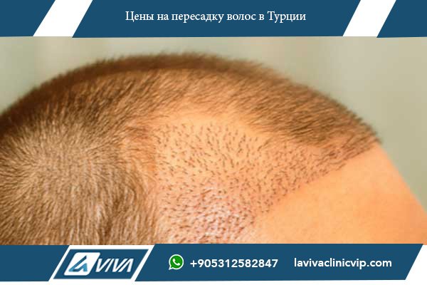 Стоматология в Приднестровье
