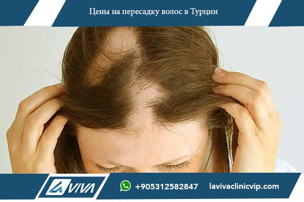 Цены на пересадку волос в Армении