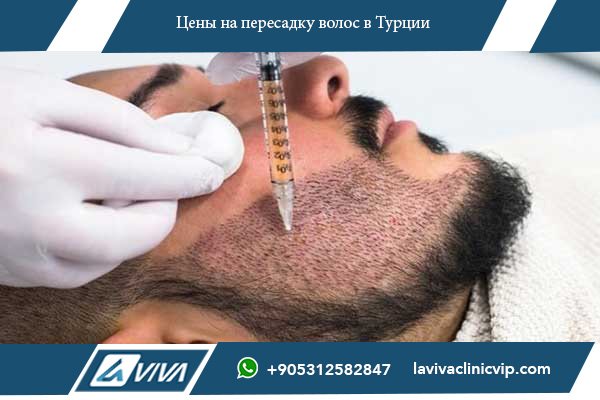 Пересадка волос в Польше