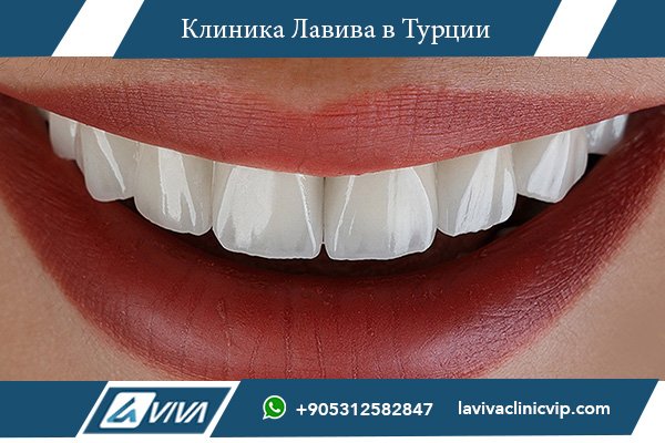 Цены на имплантацию зубов в Ирландии