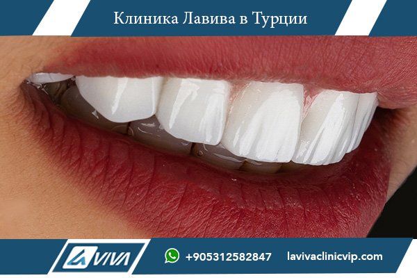 Можно ли есть орехи с зубными имплантами